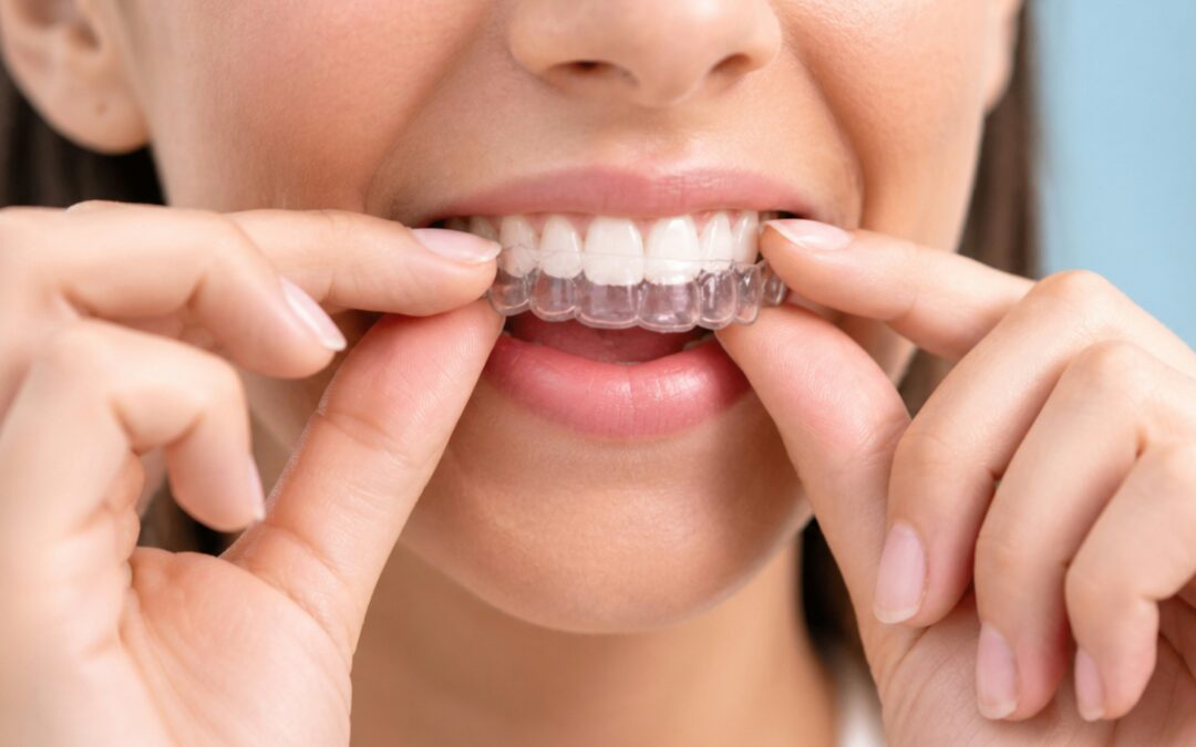 Adult Orthodontics Has Changed