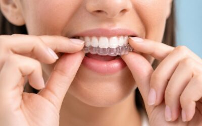 Adult Orthodontics Has Changed